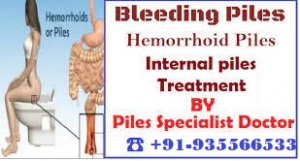 9355665333 : Specialist doctor for piles  in Moti Nagar